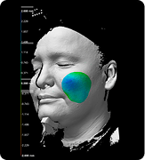 Cheek volume week 12 3D scan